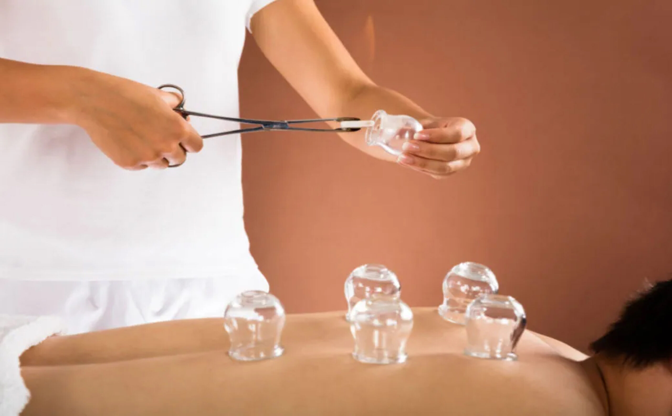 Cupping Therapy Course