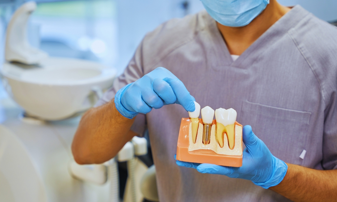 Dental Nurse Role